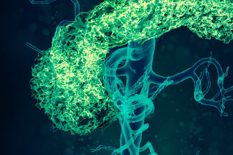 Kardio-metabolické poruchy