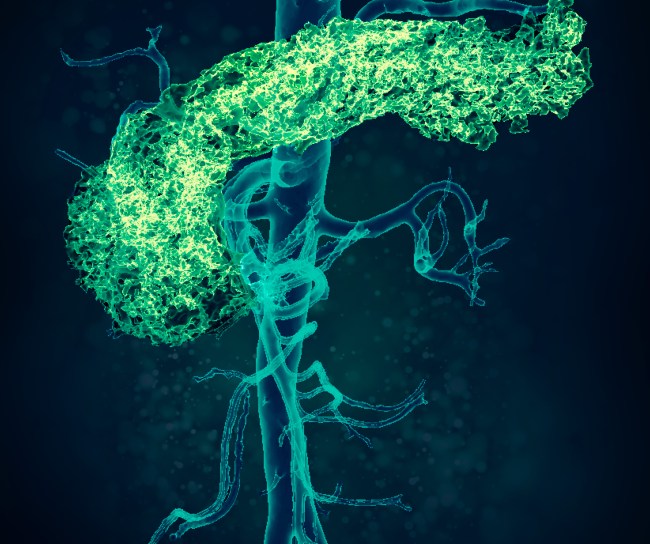 Vedecka vizualizacia-Pankreas a aorta